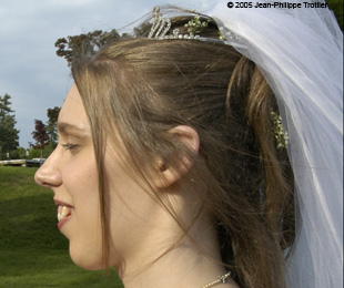 Marie-Hélène Cyr - Before orthodontic treatments and orthognathic surgeries (June 4, 2005)